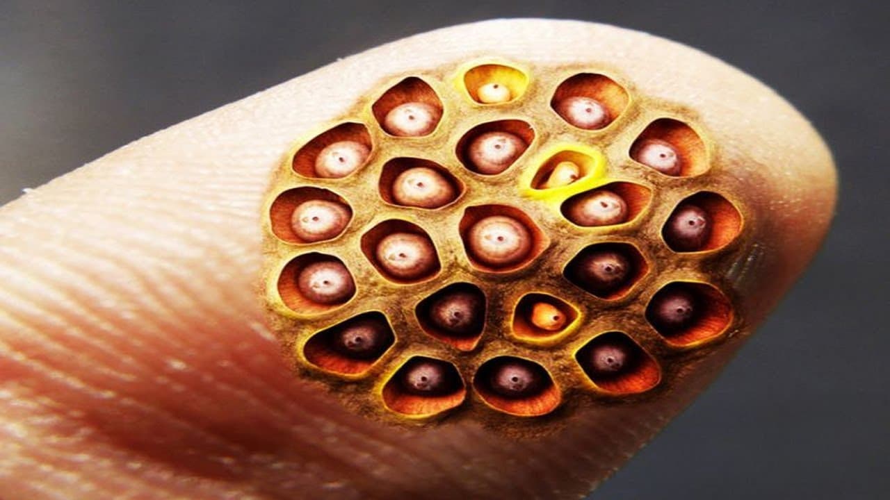 10 zvláštních fóbií, kterými můžete trpět