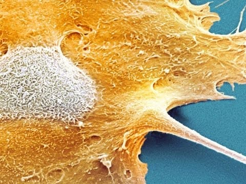 Proč nemáme všichni rakovinu?