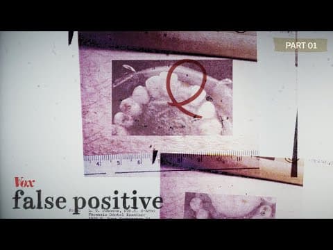 Muž byl obviněn z vraždy na základě kousnutí